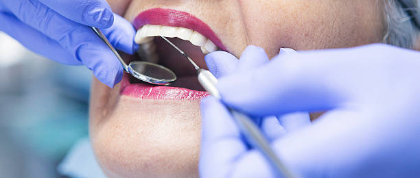 Best Weekend Emergency Dentist in Atherton, CA